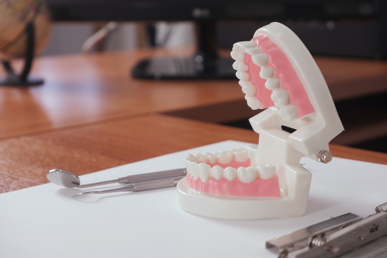 teeth model and tools on dentist desk